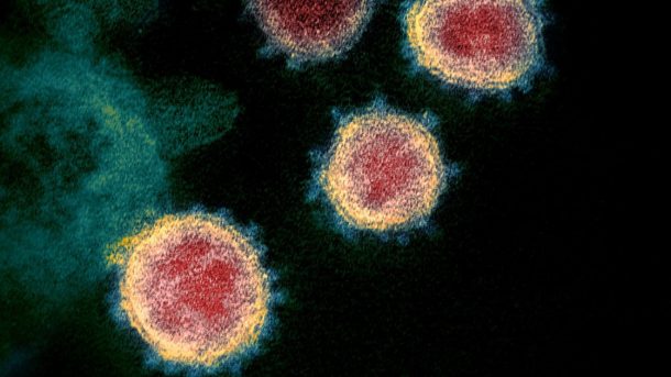 The microscopic view of the virus which causes Coronavirus disease