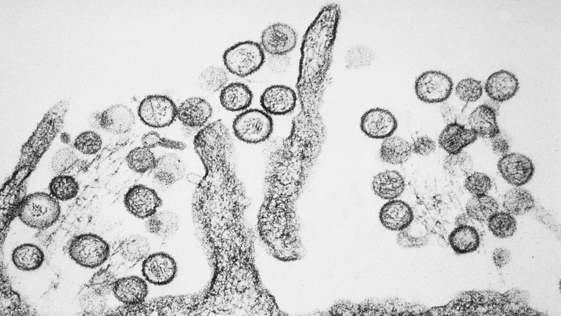 No Immediate Hantavirus Public Health Threat in Hungary